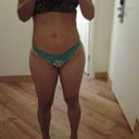 7 days post op