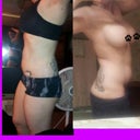 Two weeks post op