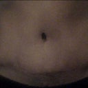 close up of scare and belly botton