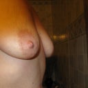 before side view