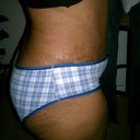 4 weeks still swollen.