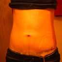 two days post op