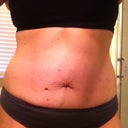 1 Day Pre-Op