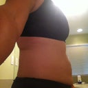 1 Day Pre-Op (Side View)