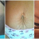 Comparing Tummy from Pre Op May '12 before exercise to Pre Op Aug '12 after working out 3 months to 4 Weeks Post Op