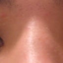 both eyes. 