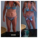 3 days post op...i am very pleased with the results so far...i know i'm going to shrink a lot more over the next few months too!