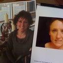 Before/After Facelift