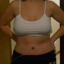 day 8 post op! I have ABS!! heheee