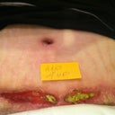 After 4 weeks. More healing.