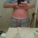 Day 7 post - op . . . not ready to show my scar yet