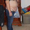 before tummy tuck