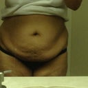 Pre-Surgery Pic 2 - I cant believe I just put this one online