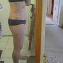 Day 1 post op
