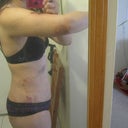 Arms day 1 post op - hard to notice