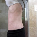 6 weeks post op