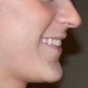 -Before- side profile