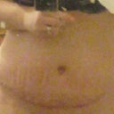here's an after about 1 1/2 weeks later.  i'm swollen but it still looks great to me.. im very happy with my rusults.. cant wait until the swelling goes down.