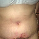 Front view at 11 dpos- after 8 hours