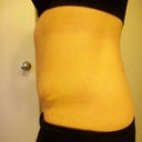 Tummy Tuck post-op