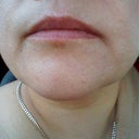 hoping you can see the entire scar...
