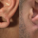 Ear Gauge Repair