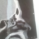 brake...  this one image doesn't do it justice!  you should see the whole C-scan!  WOW
