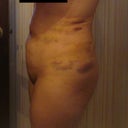 After (7 Days) - Right