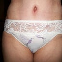 know I need a little shave/wax...sorry!!  but this shows that my incision is covered even in some bikini panties...love these panties :)