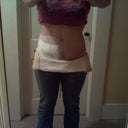 Front view...excuse the bandages...