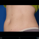3 months after