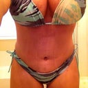 4.5 weeks post op