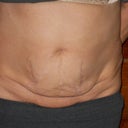 Frontal