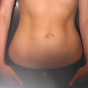 After 6 weeks