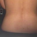 After 6 weeks