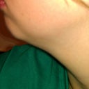 Pre - Left Side