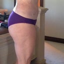 2 wks post