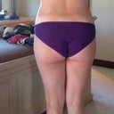 2 wks post