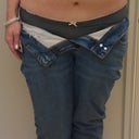 One year post op (bra size 34B)