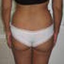BEFORE 122 LBS