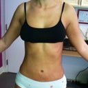 24 hours after. no bruising