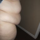 pre op side view