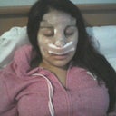 this was right after surgery, looks painful but it wasnt at all, I was still sleepy from the anesthetics.
