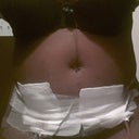 This is about 1 week PO