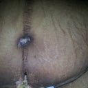 Navel and Stomach