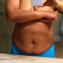 At 135 pounds (front view). Another 15 to lose before consult in May.