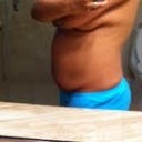 At 135 pounds (side view). Another 15 to lose before consult in May.