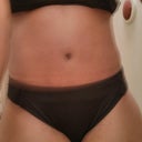 11 days PO trying on bikini bottoms