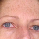 This is the before photo taken 10/1/11