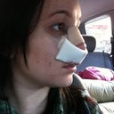After surgery